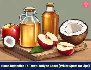 home remedies to treat fordyce spots