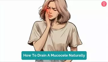 How To Drain A Mucocele Naturally