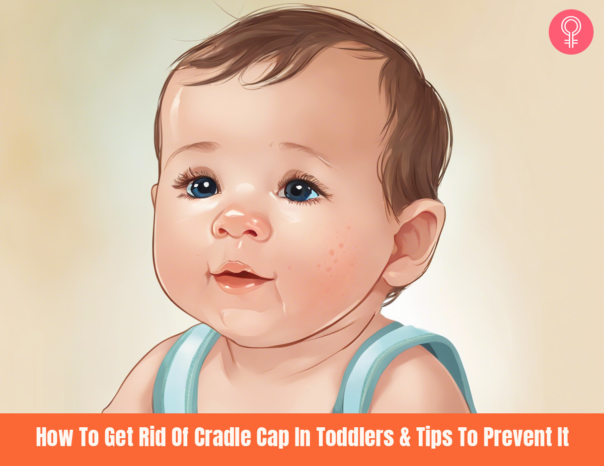 how to get rid of cradle cap in toddlers