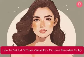 get rid of tinea versicolor