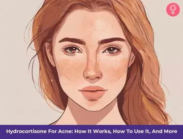 hydrocortisone for acne