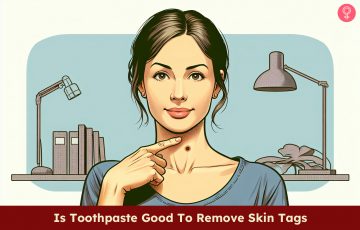 Remove Skin Tags With Toothpaste