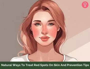 Red spots on face