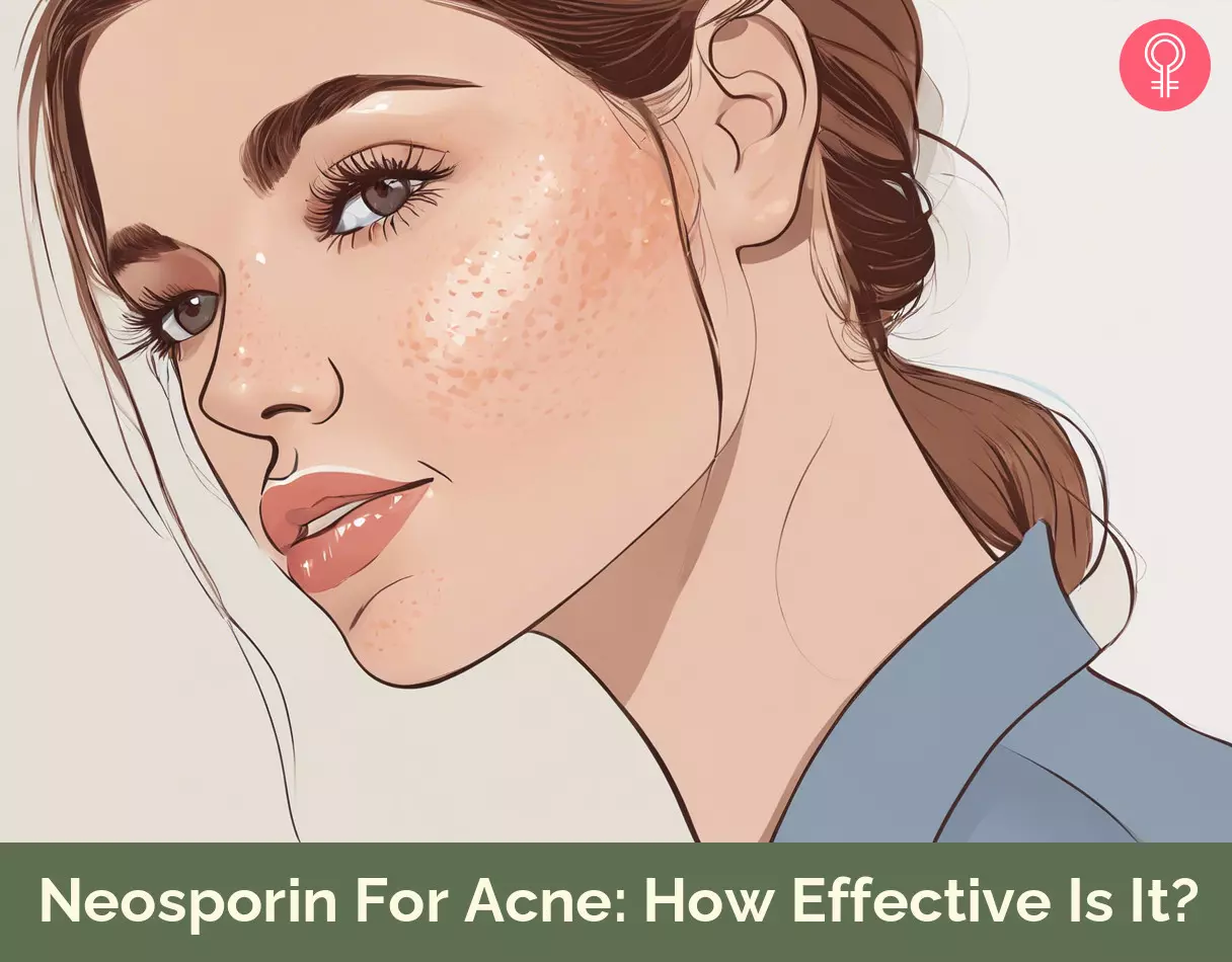 Neosporin for acne