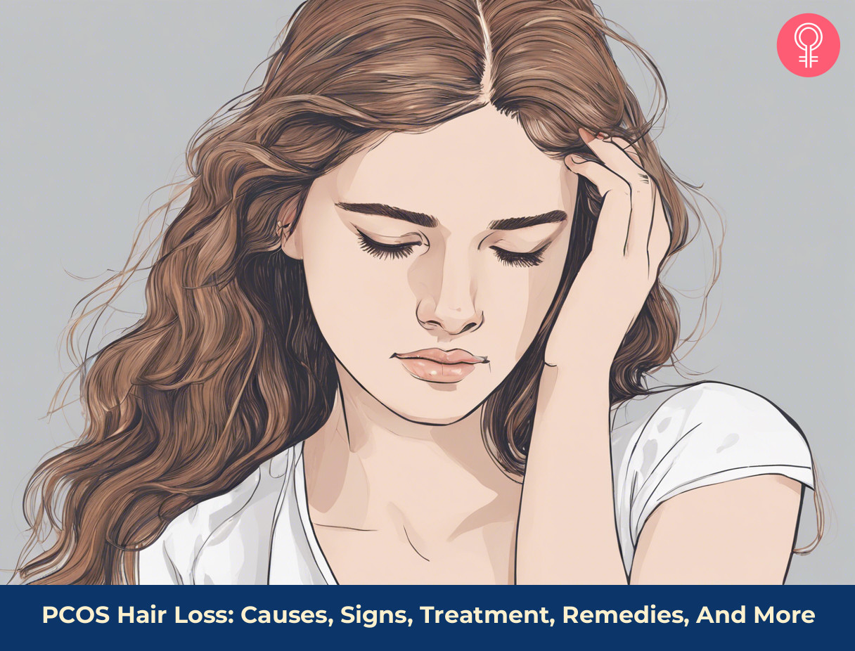 PCOS hair loss