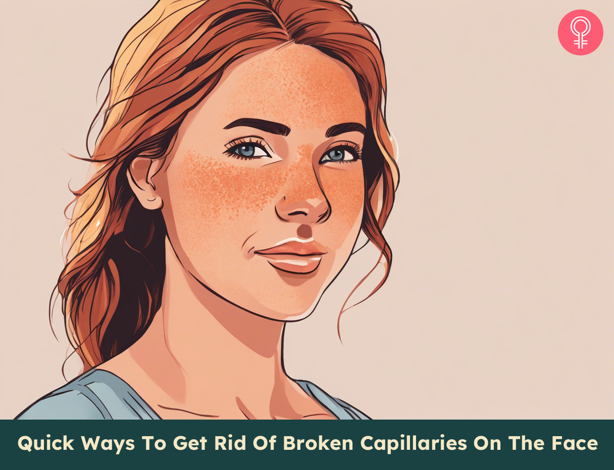 how to get rid of broken capillaries on face