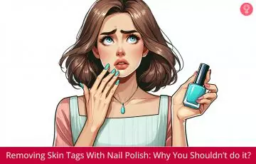 Removing Skin Tags With Nail Polish