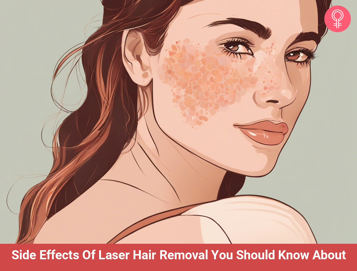 laser hair removal side effects