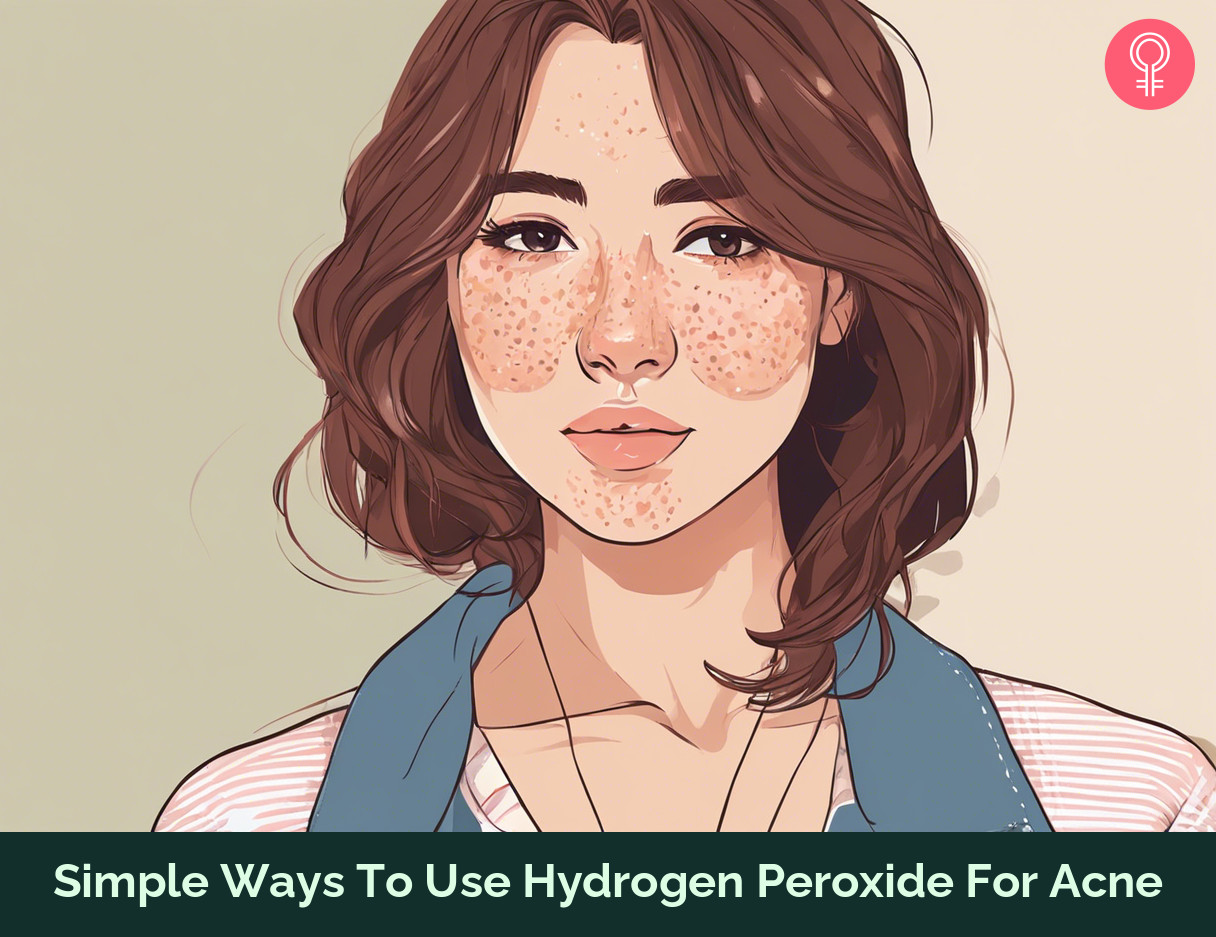 hydrogen peroxide for acne