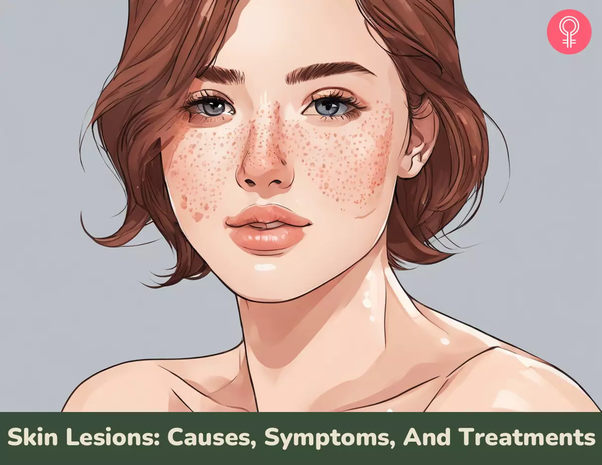 Skin Lesions