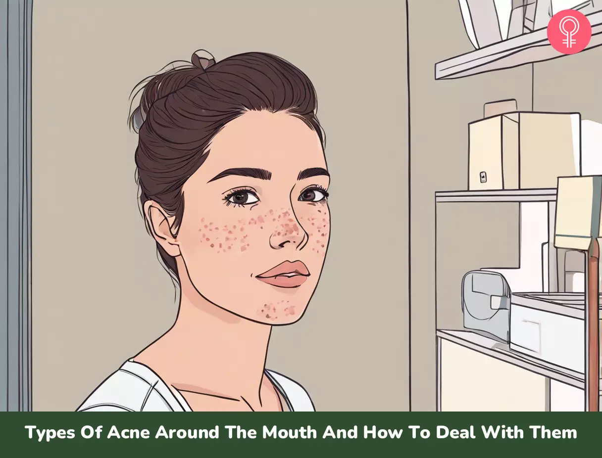 acne around the mouth