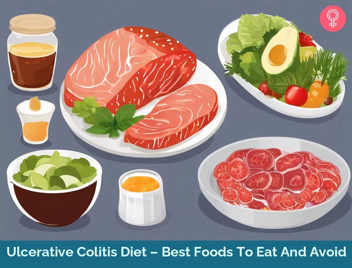ulcerative colitis diet