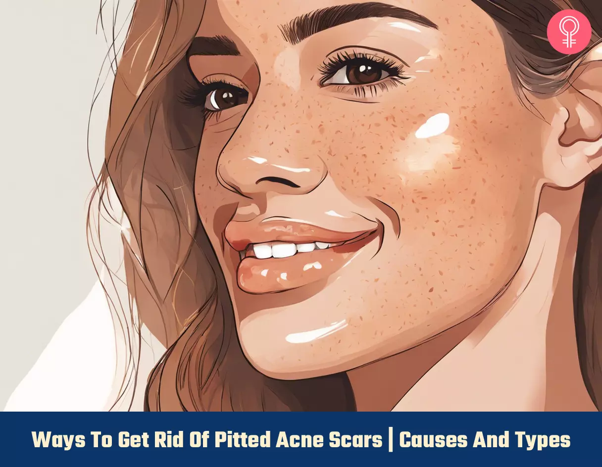 Get Rid Of Pitted Acne Scars